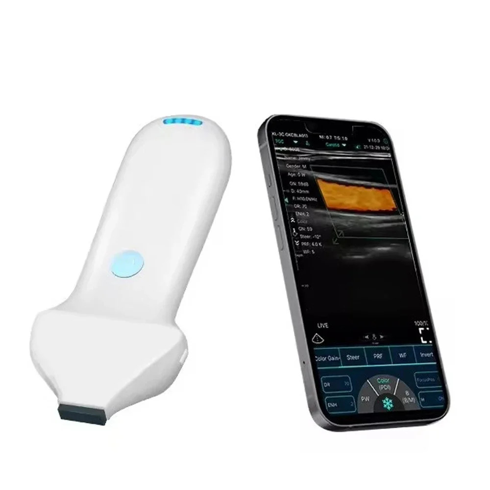192E Wireless Color Doppler Ultrasound Probe Facial High Frequency Linear Probe
