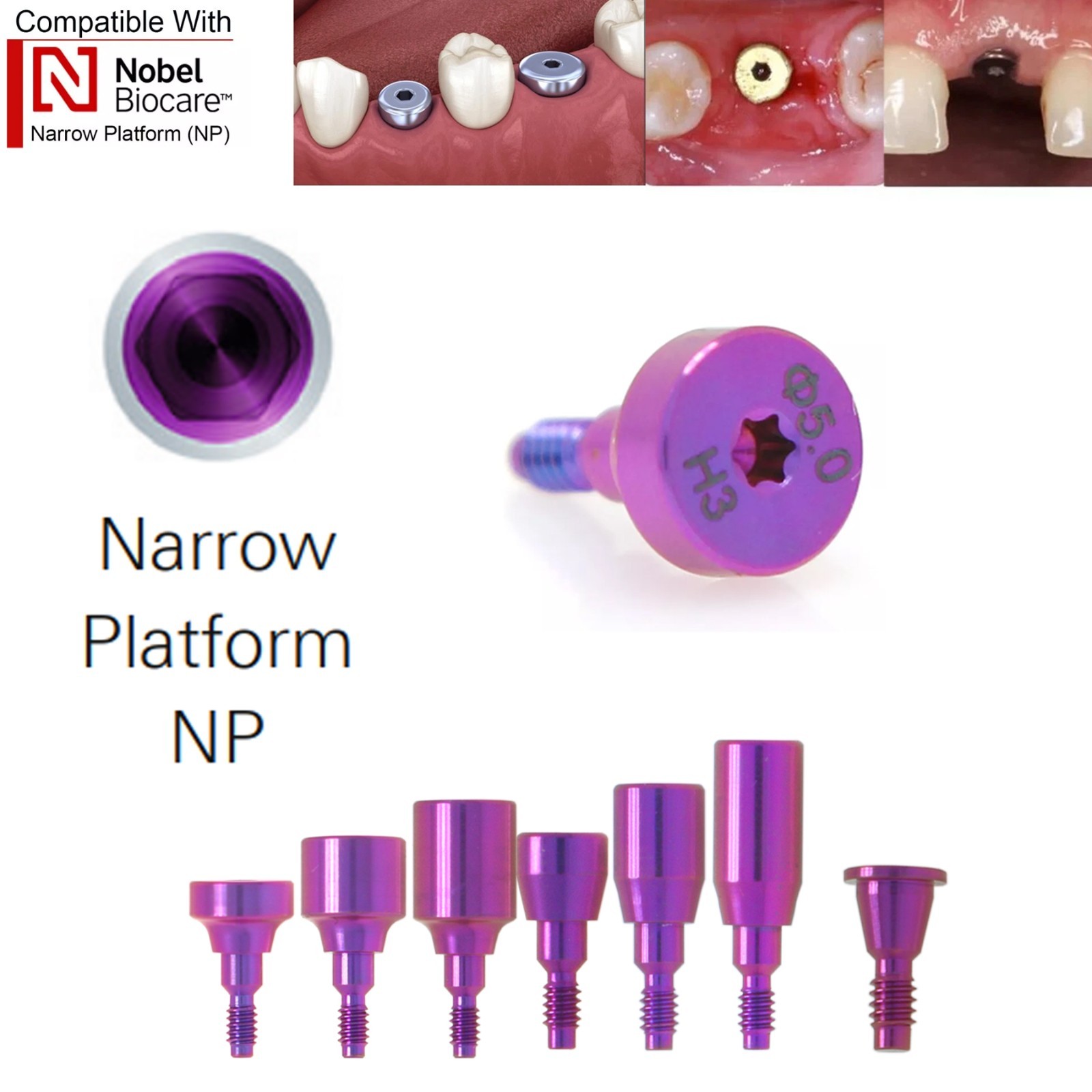 US Nobel Biocare Titanium Healing Abutment NP RP Internal Conical ∅3.6/5.0/6.0mm