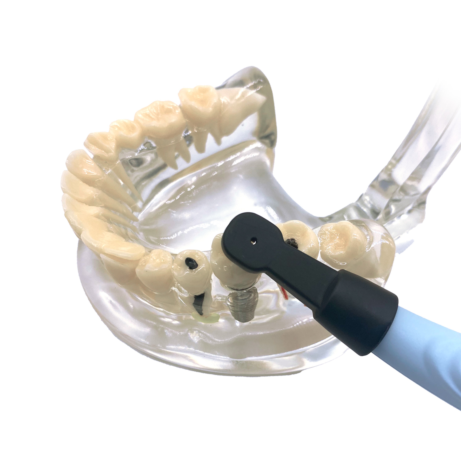 Dental Instruments Implant Detector Implant Locator 3D Smart 270° Finder Head