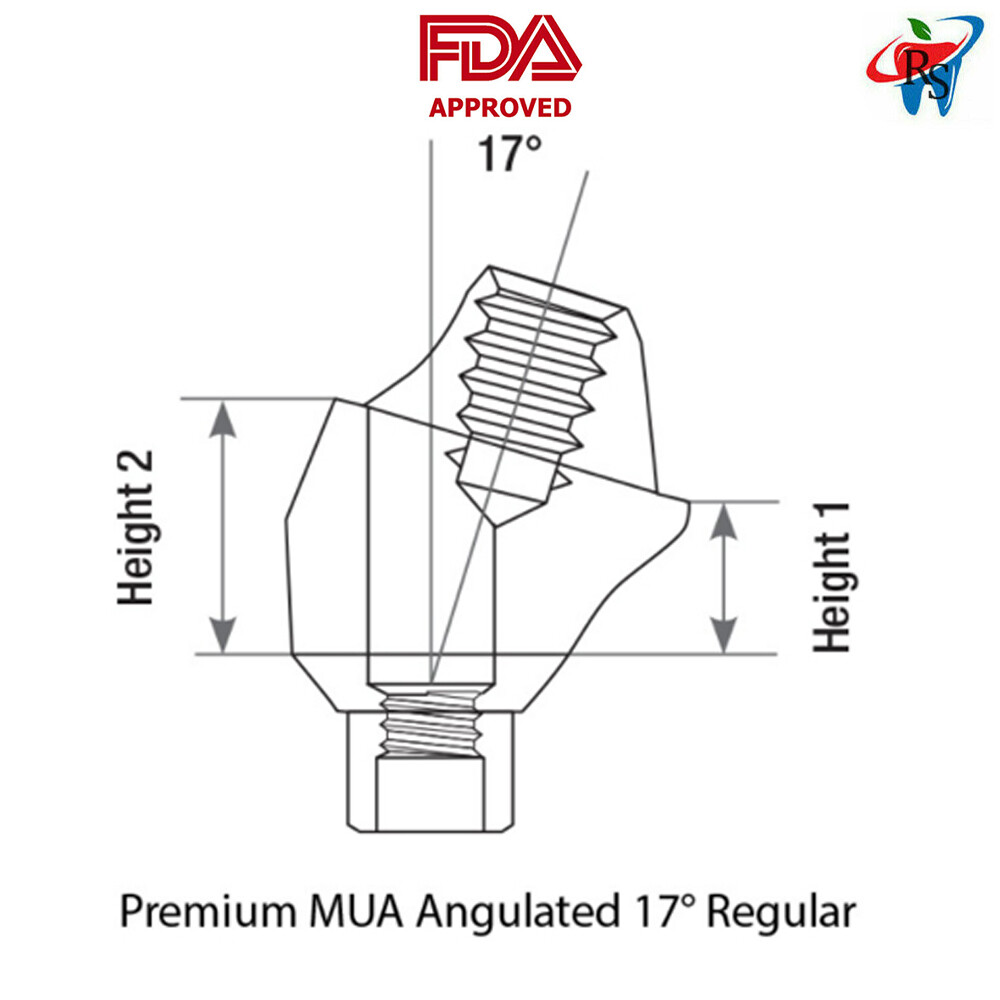 5x Set Dental Angulated 17° Multi-Unit 1.6 RP Int Hex 2.42mm + Titanium Sleeve
