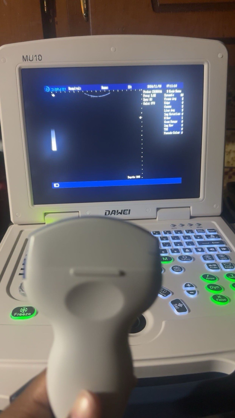 DAWEI Veterinary Ultrasound Machine Scanner with 3.5Mhz Convex Probe