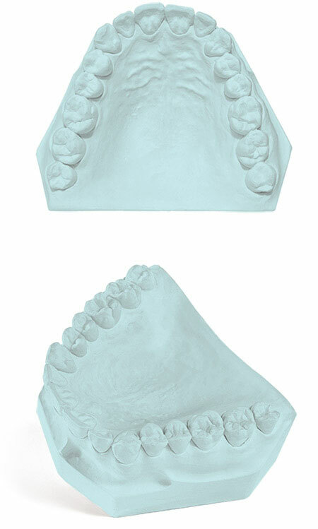 Garreco Labstone Type III Base Stone Blue 47.5bs #1051550