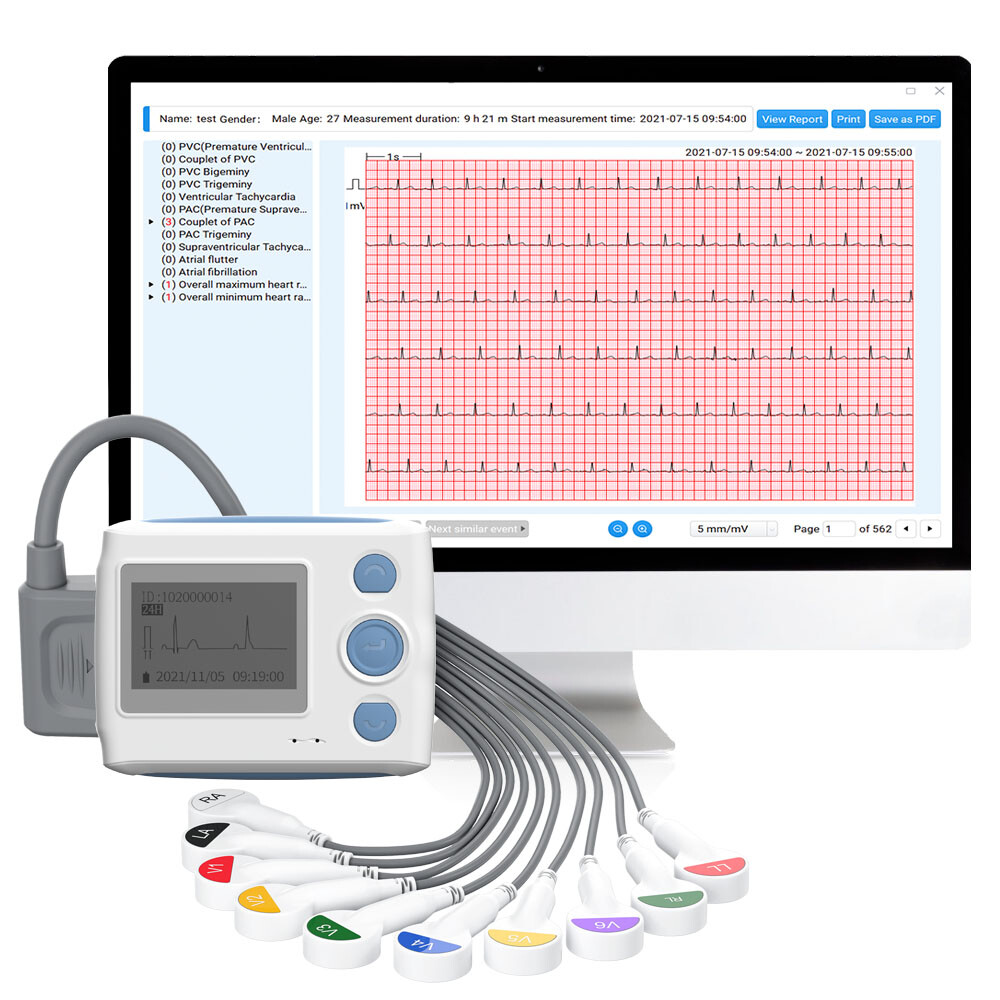 US Stock Wellue 12 lead Dynamic ECG EKG Holter Recorder 24 Hours PC AI Analysis