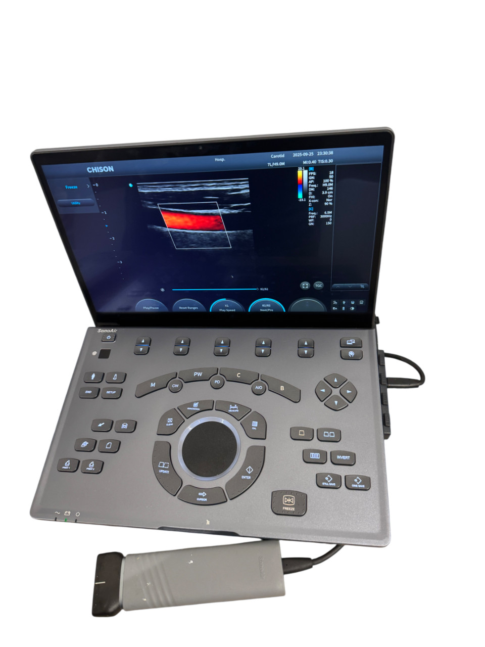 Color Doppler Portable Ultrasound SonoAir with One Linear Array Probe