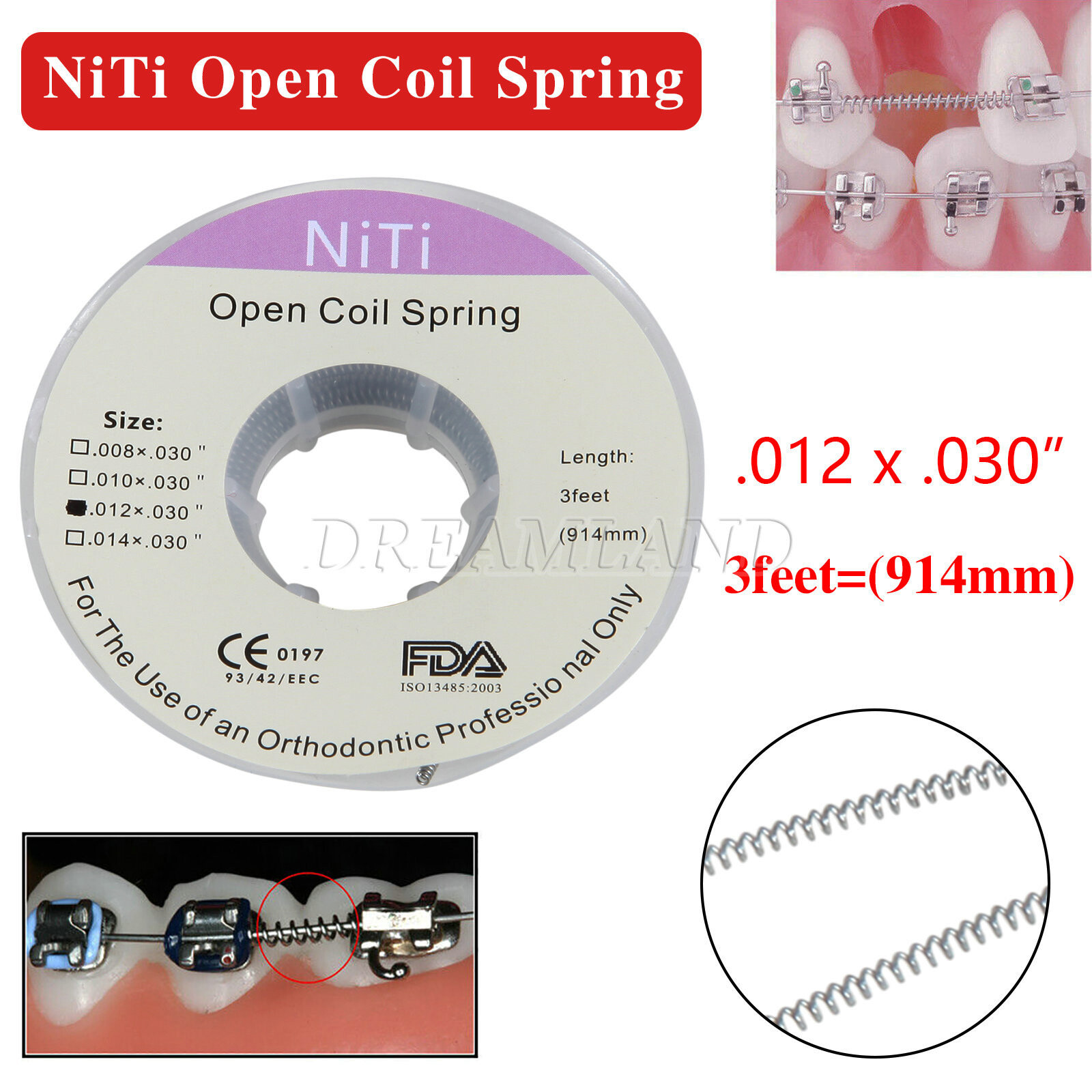 Orthodontic Niti Open Coil Spring Spool Dia.012 *030 ” inch 914mm/3 feet Dental