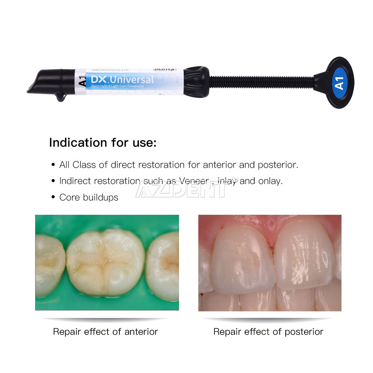 Dental Universal Light Cure Composite Resin A1-B1/Resin Heater 40/45/50℃