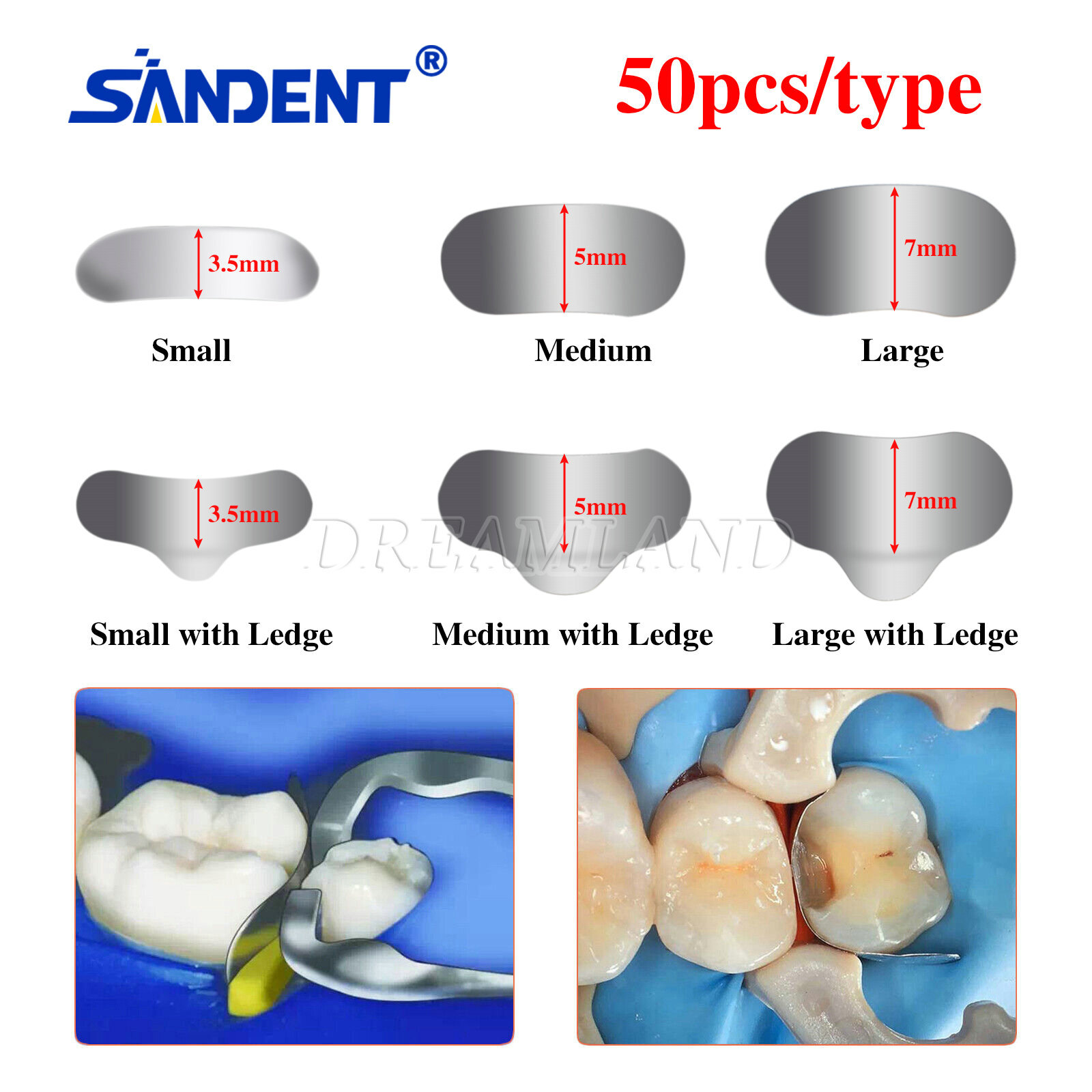 50Pcs Dental Matrix Sectional Contoured Metal Matrices Bands S/M/L 35μm FDA CE