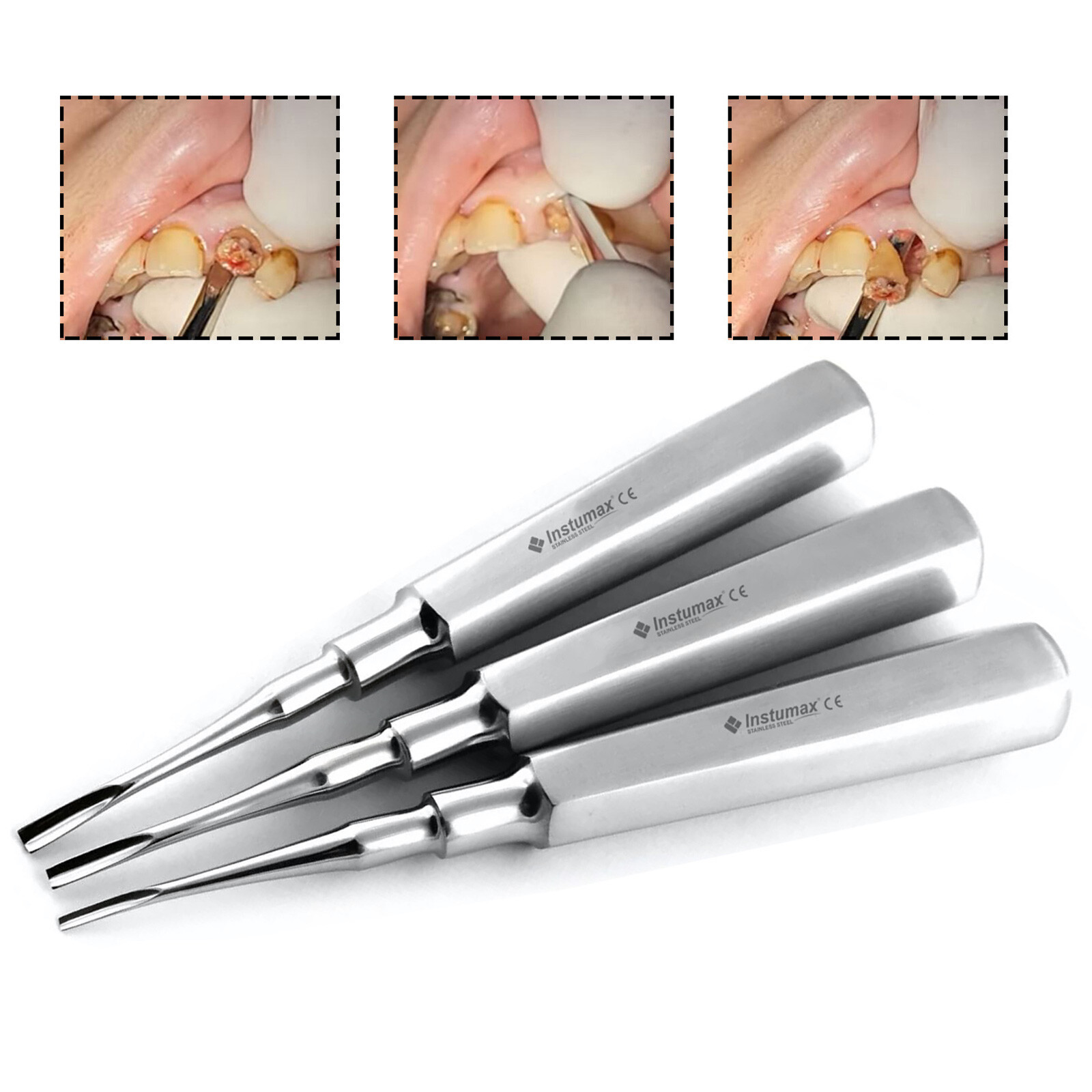 Basic Tooth Extraction Kit – Coupland Elevators, Rongeur, Plier, CE Certified