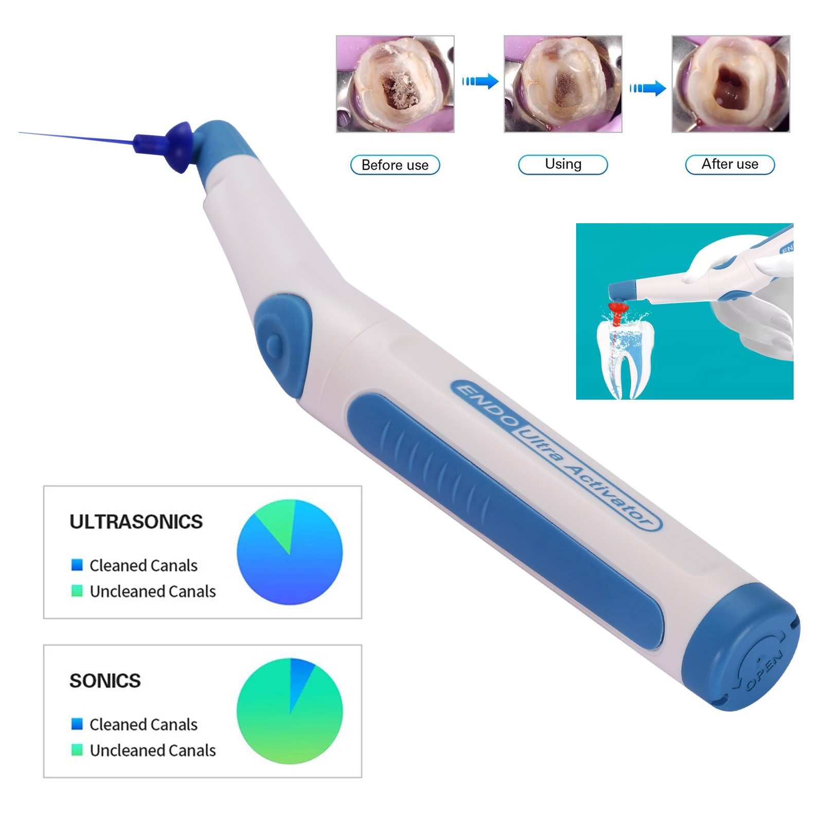 Dental LED Endo Ultrasonic Sonic Activator Root Canal Irrigator + 150Tips Free